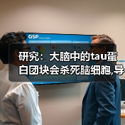 研究:大脑中的tau蛋白团块会杀死脑细胞,导致阿尔茨海默病(图4) 研究:大脑中的tau蛋白团块会杀死脑细胞,导致阿尔茨海默病(图4)